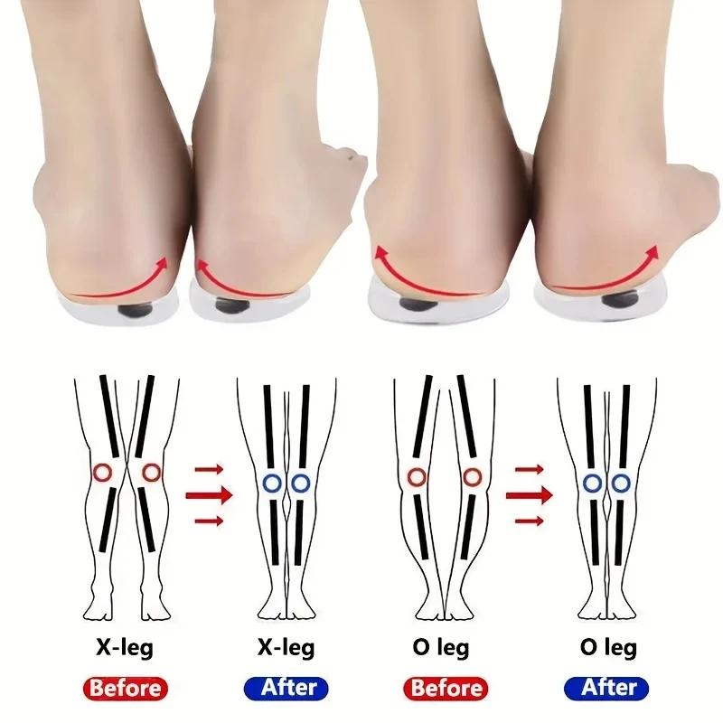Women Shoes Types - نعال تقويم العظام للأقدام ، نوع